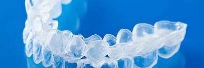 Clear braces near me | Invisalign