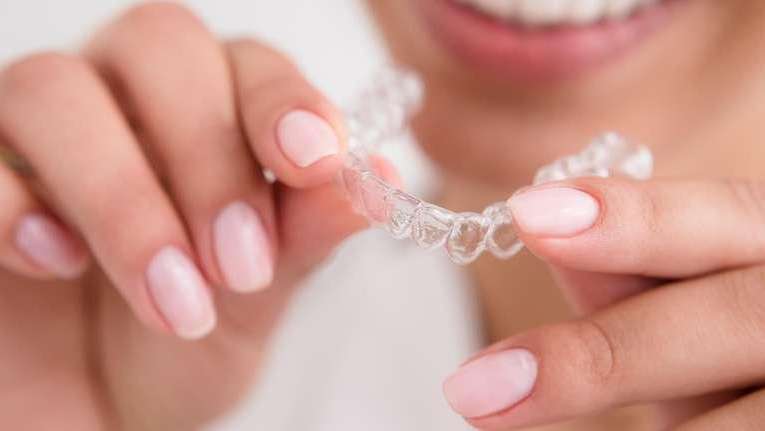 clear braces medina | woman holding aligner