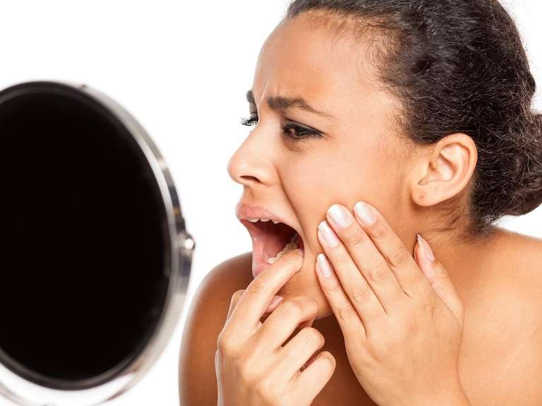 root canal medina | woman with toothache