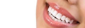 porcelain veneers in medina ohio